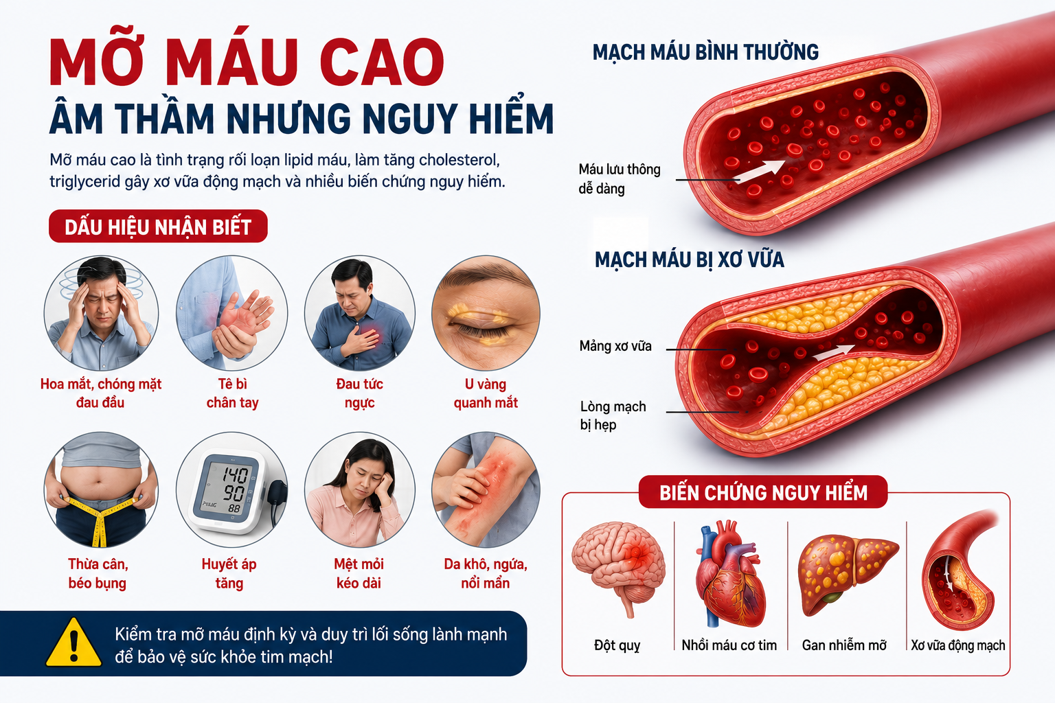 Dấu hiệu mỡ máu cao